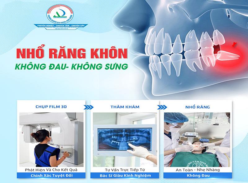 Các tai biến và biến chứng khi nhổ răng khôn